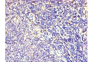 Immunohistochemistry of paraffin-embedded human lymphoid tissue using ABIN7152464 at dilution of 1:100 (FBXL18 anticorps  (AA 1-365))