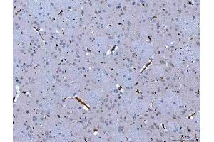 IHC analysis of SEMA4F using anti-SEMA4F antibody (ABIN7601432).