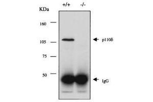 Anti-PI3K p110d Antibody - Western Blot Immunoprecipitation and western blot using ROCKLAND Immunochemical's Rabbit-anti-PI3K p110d antibody.