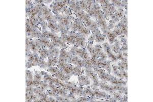 Immunohistochemical staining of human liver with NHLRC3 polyclonal antibody  shows strong cytoplasmic positivity with granular pattern in hepatocytes at 1:10-1:20 dilution. (NHLRC3 anticorps)