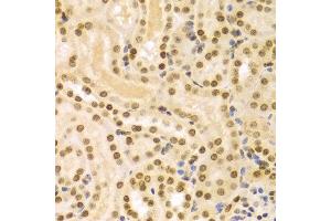 Immunohistochemistry of paraffin-embedded Mouse kidney using DKC1 antibody at dilution of 1:100 (x400 lens). (DKC1 anticorps  (AA 245-514))