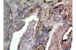 Immunohistochemistry (IHC) analysis of paraffin-embedded Human Lung, antibody was diluted at 1:100.