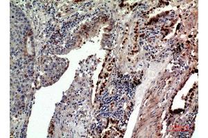 Immunohistochemistry (IHC) analysis of paraffin-embedded Human Lung, antibody was diluted at 1:100. (CD163L1 anticorps  (Internal Region))
