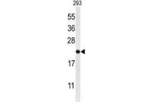 Western blot analysis of MRAP (arrow) in 293 cell line lysates (35ug/lane) using MRAP Antibody (N-term). (MRAP anticorps  (N-Term))