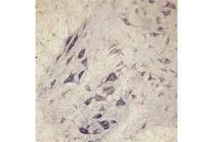 IHC on rat spinal cord using Rabbit antibody to Vesicle-trafficking protein SEC22b (SEC22B, SEC22L1,  ERS24): IgG (ABIN351370) at a concentration of 30 µg/ml.