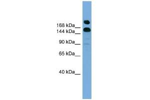 WB Suggested Anti-UGCGL1 Antibody Titration:  0.