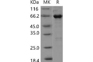 Western Blotting (WB) image for EPH Receptor A3 (EPHA3) (AA 569-984) protein (GST tag,His tag) (ABIN7319998)