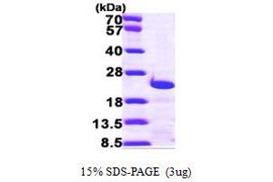 Centrin, EF-Hand Protein, 3 (CETN3) (AA 1-167) protein (His tag)