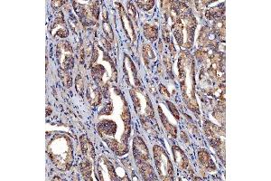 IHC analysis of SDF2L1 using anti-SDF2L1 antibody (ABIN7601111). (SDF2L1 anticorps  (AA 29-221))