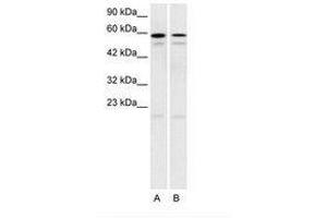 Image no. 1 for anti-5-Hydroxytryptamine (serotonin) Receptor 2C (HTR2C) (AA 28-77) antibody (ABIN202566) (HTR2C anticorps  (AA 28-77))