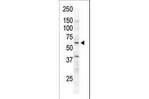 The anti-RYK Pab (ABIN392050 and ABIN2841818) is used in Western blot to detect RYK in Jurkat cell lysate.