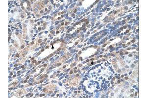 NOLC1 antibody was used for immunohistochemistry at a concentration of 4-8 ug/ml. (NOLC1 anticorps  (C-Term))