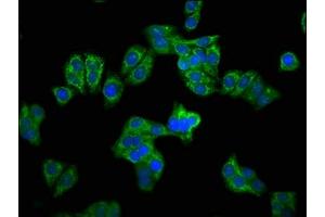 Immunofluorescence staining of HepG2 cells with ABIN7146668 at 1:100, counter-stained with DAPI.