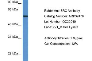 WB Suggested Anti-SRC Antibody Titration: 0.