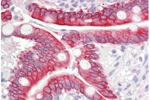 Image no. 3 for anti-Isoleucyl-tRNA Synthetase 2, Mitochondrial (IARS2) (AA 71-120) antibody (ABIN2879166) (IARS2 anticorps  (AA 71-120))