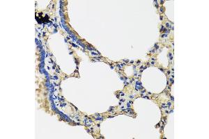 Immunohistochemistry of paraffin-embedded rat lung using IL36G antibody (ABIN5974550) at dilution of 1/100 (40x lens). (IL1F9 anticorps)