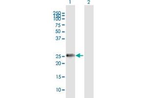Western Blot analysis of MMP7 expression in transfected 293T cell line by MMP7 MaxPab polyclonal antibody. (MMP7 anticorps  (AA 1-267))