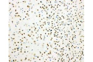 IHC-F testing of mouse brain tissue (HDAC3 anticorps  (AA 411-428))