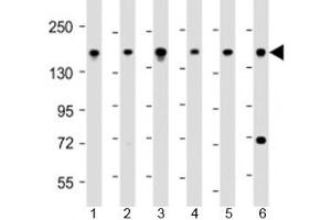 Western blot testing of human 1) 293T/17, 2) DU-145, 3) LNCaP, 4) Raji, 5) U-2OS and 6) HeLa cell lysate with PDS5B antibody at 1:2000. (PDS5B anticorps  (AA 1197-1228))