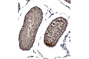 IHC analysis of PRDM14 using anti-PRDM14 antibody (ABIN7603152).