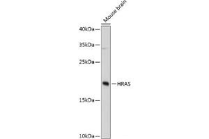 Western blot analysis of extracts of Mouse brain using HRAS Polyclonal Antibody at dilution of 1:3000. (HRAS anticorps)