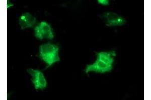 Immunofluorescence (IF) image for anti-Interferon Regulatory Factor 6 (IRF6) antibody (ABIN1498903)