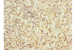 Immunohistochemistry of paraffin-embedded human spleen tissue using ABIN7171372 at dilution of 1:100 (CD1c anticorps  (AA 18-300))