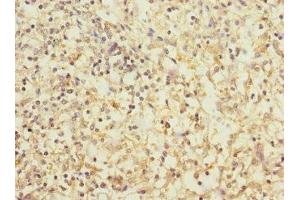 Immunohistochemistry of paraffin-embedded human spleen tissue using ABIN7171372 at dilution of 1:100
