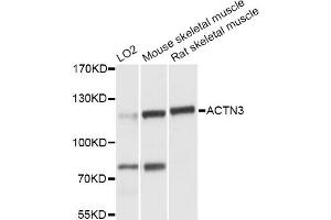 Western blot analysis of extracts of various cell lines, using ACTN3 antibody (ABIN6290057) at 1:3000 dilution. (ACTN3 anticorps)