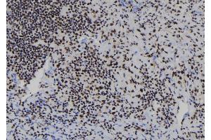 ABIN6278106 at 1/100 staining Human spleen tissue by IHC-P.