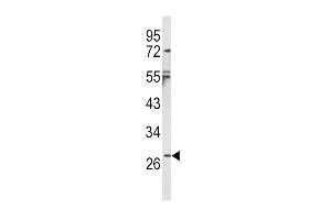 Western blot analysis of IL1B Antibody (Center) (ABIN652470 and ABIN2842321) in NCI- cell line lysates (35 μg/lane).