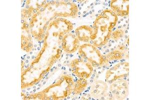 Immunohistochemistry of paraffin embedded rat kidney using CYP20A1 (ABIN7073675) at dilution of 1: 700 (400x lens)