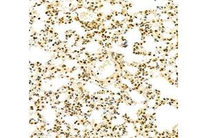 Immunohistochemistry of paraffin embedded mouse lung using tfiib (ABIN7074034) at dilution of 1: 900 (250x lens) (GTF2B anticorps)