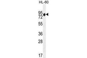 ZNF665 Antibody (N-term) western blot analysis in HL-60 cell line lysates (35 µg/lane). (ZNF665 anticorps  (N-Term))
