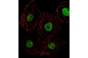 Fluorescent image of HUVEC cell stained with HOXD8 Antibody (C-term) (ABIN1536919 and ABIN2850170).
