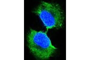 Confocal immunofluorescence analysis of PC-3 cells using GSTP1 antibody (green). (GSTP1 anticorps)