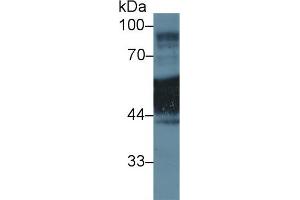 Western Blot; Sample: Human A431 cell lysate; Primary Ab: 1µg/ml Rabbit Anti-Rat KRT1 Antibody Second Ab: 0.