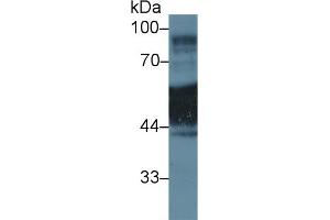 Western Blot; Sample: Human A431 cell lysate; Primary Ab: 1µg/ml Rabbit Anti-Rat KRT1 Antibody Second Ab: 0.