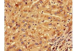 Immunohistochemistry of paraffin-embedded human liver tissue using ABIN7157273 at dilution of 1:100