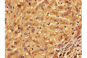 Immunohistochemistry of paraffin-embedded human liver tissue using ABIN7157273 at dilution of 1:100 (KLHL2 anticorps  (AA 1-155))