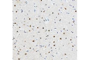 IHC analysis of RFX3 using anti-RFX3 antibody (ABIN7601095).