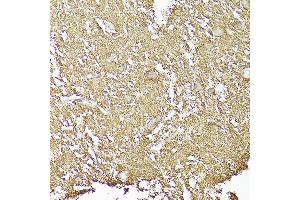 Immunohistochemistry of paraffin-embedded human brain using CD90/Thy1 Rabbit mAb (ABIN6129735, ABIN6148554, ABIN6148555 and ABIN7101405) at dilution of 1:100 (40x lens). (CD90 anticorps)