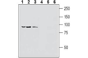 Western blot analysis of human  breast adenocarcinoma cell line lysate (lanes 1 and 4), human LNCaP prostate adenocarcinoma cell line lysate (lanes 2 and 5) and human HMC3 microglia cell line lysate (lanes 3 and 6):1-3.
