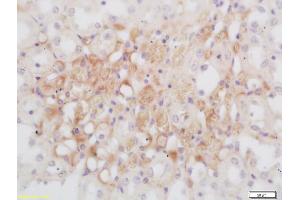Formalin-fixed and paraffin embedded rat kidney labeled with Rabbit Anti GNMT Polyclonal Antibody, Unconjugated (ABIN739680) at 1:200 followed by conjugation to the secondary antibody and DAB staining (GNMT anticorps  (AA 51-150))
