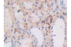 Detection of MHCC in Human Kidney Tissue using Polyclonal Antibody to Major Histocompatibility Complex Class I C (MHCC) (MHCC (AA 48-305) anticorps)