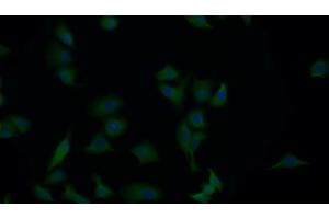 Detection of APAF1 in Human Hela cell using Polyclonal Antibody to Apoptotic Peptidase Activating Factor 1 (APAF1)