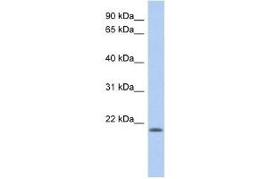 CHAC2 antibody used at 1 ug/ml to detect target protein. (CHAC2 anticorps)