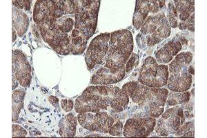 Image no. 11 for anti-Methionyl Aminopeptidase 2 (METAP2) (AA 2-212) antibody (ABIN1491153) (METAP2 anticorps  (AA 2-212))