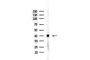anti-phosphoserine Aminotransferase 1 (PSAT1) (Internal Region) antibody