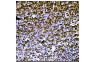 IHC analysis of PML Protein/Pml using anti-PML Protein/Pml antibody (ABIN7599678). (PML anticorps  (AA 107-857))
